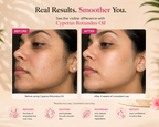 Cyperus Hair Reduction Serum™