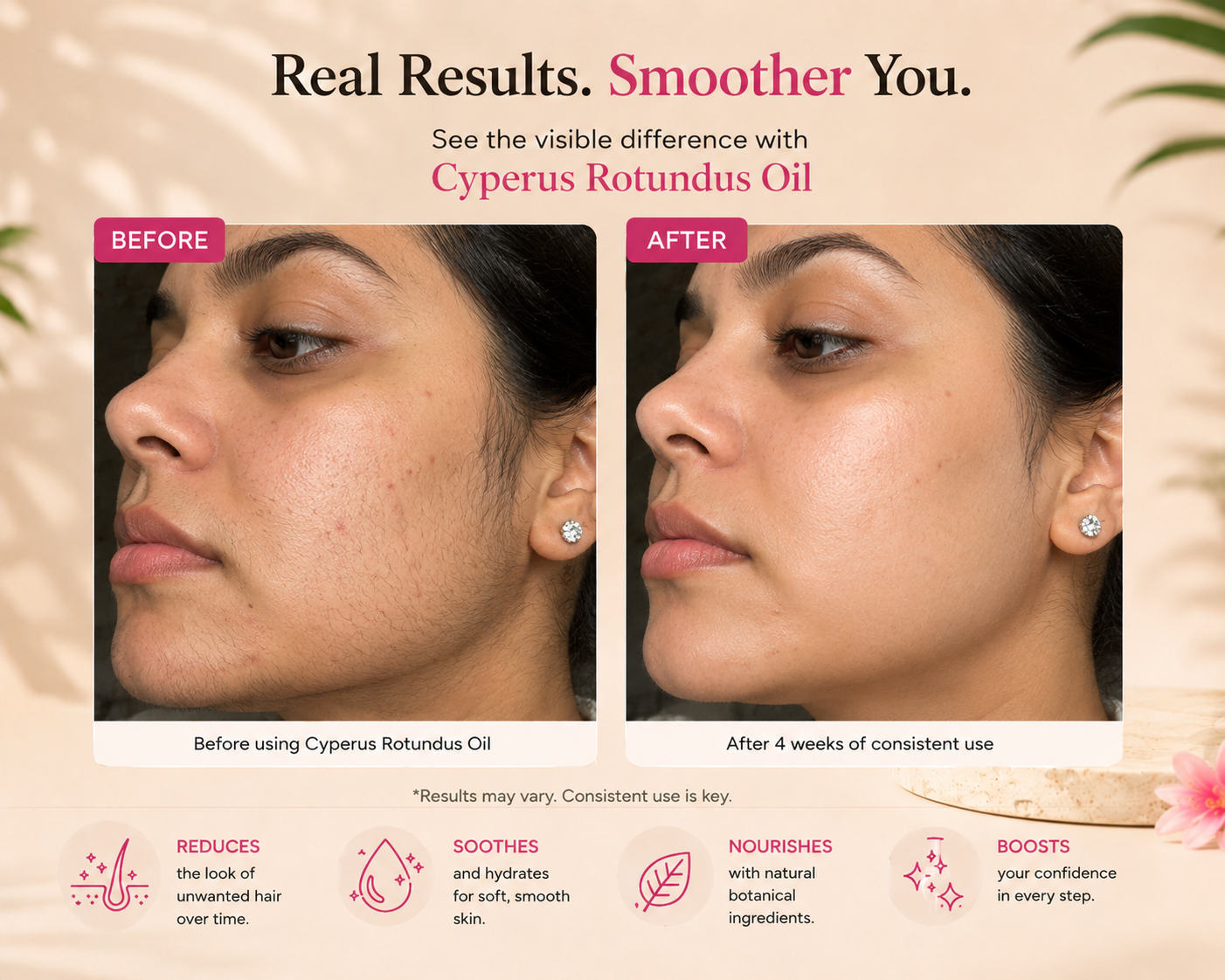 Cyperus Hair Reduction Serum™