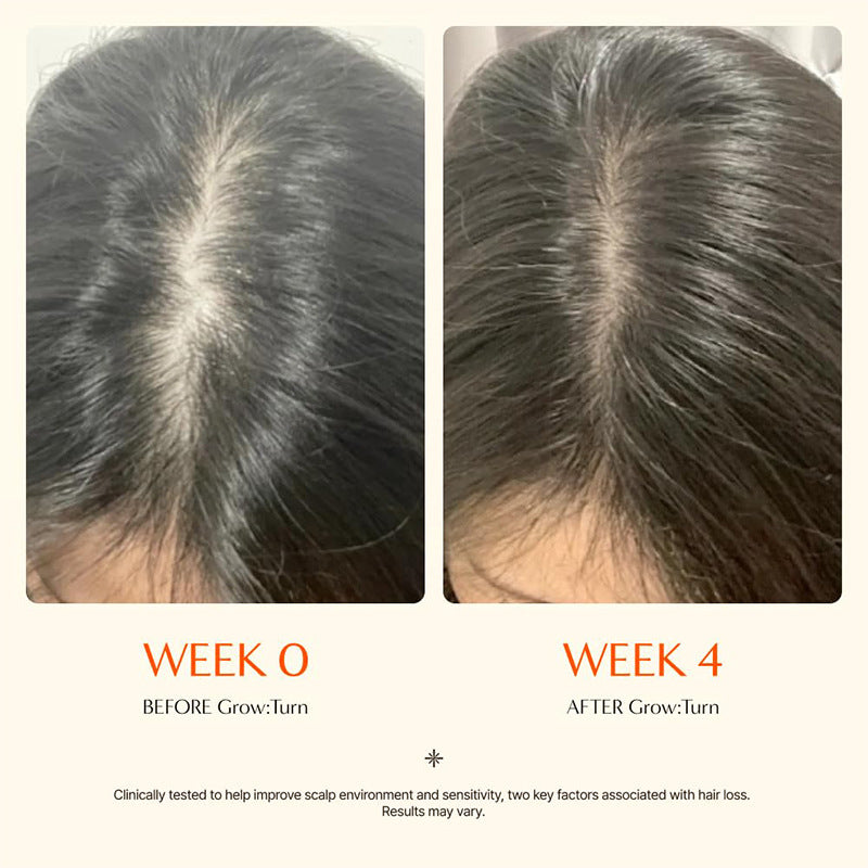Relax & Revitalize Scalp Massager - #1 Korean Exosome Serum + Scalp Brush - Clinically Proven